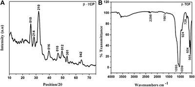 Nanostructured β‐tricalcium Phosphate (Ca3(PO4)2 Based Electrochemical Sensor for Detection of Methyl Parathion and Mercury (II) Ions